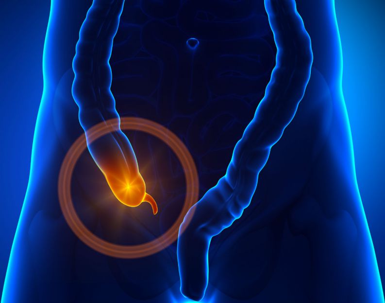 How To Know Appendicitis And How To Prevent It 