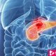What Are The Treatment Of Pancreatitis ebuddynews