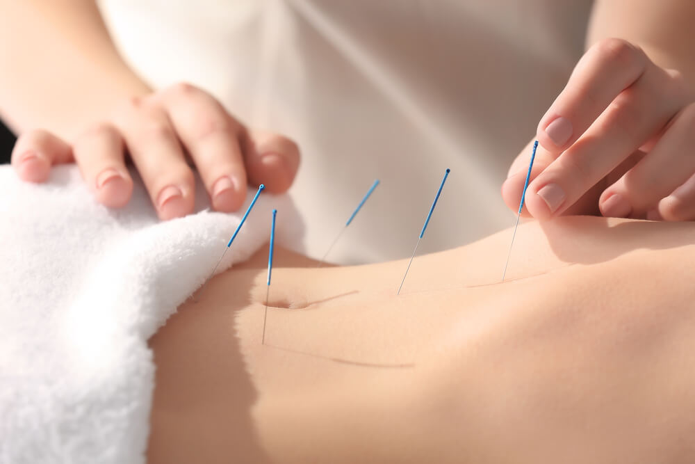 5 Amazing Acupuncture Benefits That You Never Knew - ebuddynews