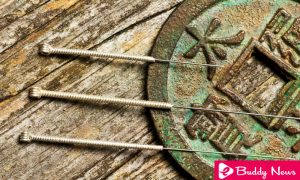 5 Amazing Acupuncture Benefits That You Never Knew - ebuddynews