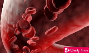 Most Common Types of Vasculitis In People Of All Ages - ebuddynews