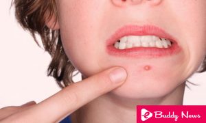 Fighting Boils - eBuddy News