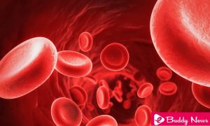 Poikilocytosis Symptoms Causes and Treatment - eBuddy News