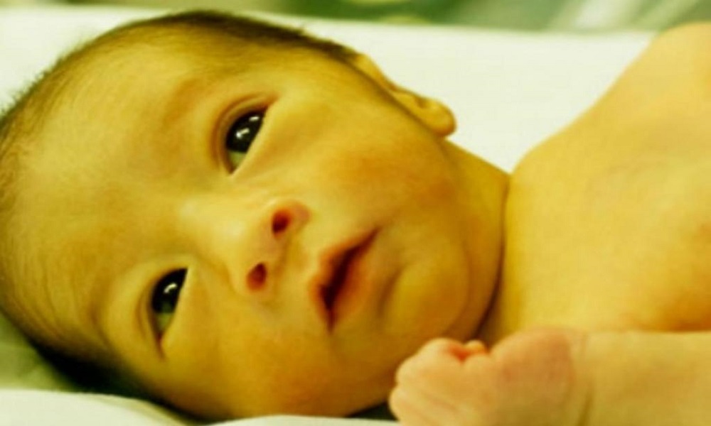 Hyperbilurrubinemia in the Newborn - eBuddy News