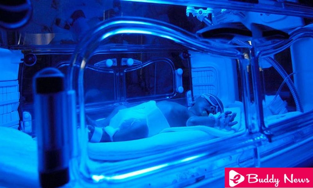Jaundice In The Newborn, What Should I Know - eBuddy News