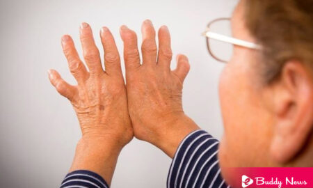 What Is Arthritis And Its Types With Diagnosis Treatment And Prevention - ebuddynews
